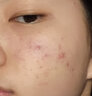 百植萃小绿瓶精华液舒缓修护控油淡红补水保湿送女友礼物 【尝鲜装】小绿瓶精华5ml 实拍图