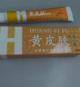 黄皮肤儿童乳膏15g 儿童宝宝用抑菌软膏神霸黄皮肤草本植物抑菌膏外用乳膏 实拍图