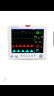 瑞博PM-9000A+12.1寸多参数监护仪心电监护仪家用医用监护仪 标配+锂电池+打印 实拍图