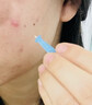 可孚 医用无菌粉刺针一次性清痘针清痘痘挑痘清工具 仿若无痛*2 实拍图