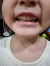 漫婵儿童洁牙擦牙菌斑祛除色素沉淀牙齿清洁牙渍牙垢去除黑斑黑牙神器 1盒6枚 实拍图