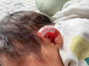 艾妮心新生婴儿儿童爱美耳夹硅胶耳廓贴非耳朵矫正器耳型环缩耳垂耳隐耳 一个专利A款+配硅胶贴+指导 晒单实拍图