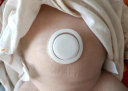 Care1st嘉卫士 婴儿疝气贴 脐疝贴 婴儿凸肚脐专用 压疝气肚脐贴10贴 实拍图
