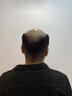 鼎盛摩尔金鼎盛摩尔 假发男发际线男士假发片补头顶隐形秃顶中分无痕补发 AI补发修剪意向金 短发 实拍图