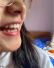牙美佳磨牙套睡觉防磨牙牙套专用口腔护齿咬胶磨牙垫矫正磨牙神器成人 实拍图
