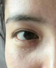 南京同仁堂脂肪粒去除神器汗管粒油脂粒颗粒清肌精华液眼霜补水保湿男女30ml 1瓶30ml 实拍图