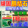 古都老方胆结石排石药100%胆囊炎结石专用的药溶 石化石排石胆结石专用贴 特效9盒【家庭优惠装】买5送4 肾结石德国消石素日本进口息肉 实拍图