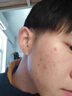 韩纪祛痘膏 青春痘痤疮洗面奶 控油消除精华液青少年痘印痘坑痘痘淡化 三件套 实拍图