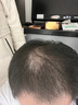 章光101瑞丝防脱发育发液头发增长液育发剂改善男生女生头发量稀疏秃顶 3瓶周期装送生姜洗发水360G1瓶 实拍图