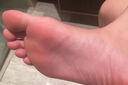 脚气药止痒脱皮烂脚丫真菌感染根药治脚气烂脚丫的特新效药脚烂脚趾缝痒溃烂水泡型严重脚气专用药克霉唑乳膏 3乳膏+3喷雾【搭配使用 效果佳【发货特效】止痒药 实拍图