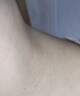 吻音黑棘皮病脖子黑色素黑棘皮症腋下手肘关节黑可搭专用白愈康乳膏NB 药监备案【一盒、体验装】白愈康导光凝胶 实拍图