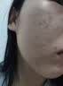 医康方仁维生素c软膏去黑色素褪黑素沉淀外用脸上黑斑去除医用美淡斑祛痘 实拍图