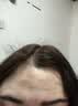 乐草元洗发水植物旗舰萃取清洁头皮免洗清爽控油滋养蓬松男女通用 去屑+韧发养根 实拍图