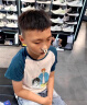 Aehig艾西格抗过敏鼻炎益生菌过敏性鼻窦炎荨麻湿疹皮肤过敏成人儿童 赠品维生素5 实拍图