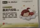 明生博士儿童鼻炎医用穴位磁疗贴急慢性鼻炎砭贴鼻塞通气鼻痒鼻窦炎 2盒【调理轻度鼻炎】 实拍图