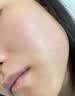 逆光疹去闭i口粉刺克星小孩脸上长硬疙瘩丘疹额头上长小粒痘痘有炎症的样子修复皮肤屏障祛痘除螨去除药膏医 逆光疹闭口粉刺专用膏 实拍图