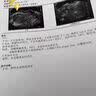 SorLife诗丽芙dhea备孕保养卵巢大龄女性备孕助怀孕试管排泡卵巢早衰 【享8折 大龄备孕推荐】 60粒*5瓶 巩固装 实拍图