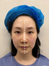 双逆博士抗衰仪器脸面部美容仪提升拉紧致神器淡纹祛皱美容院专用 明黄色 双逆博士顶配二万发（带黄金微针） 实拍图