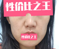 金稻 蒸脸器美容仪热喷纳米加湿器补水仪面膜搭档蒸脸仪热喷蒸脸器生日礼物 KD2331B樱花粉 实拍图