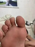欣盛佳园去脚底老茧去硬皮专用手茧脚茧脚钉厚茧软化去除神器祛茧王抗菌液 祛茧王 实拍图