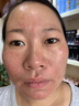 佰萃莱美白祛斑霜烟酰胺官方淡化黑色素旗舰去雀斑黄褐斑男女 实拍图