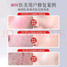 FANCIE MANLIN医用修复面膜械字号水光针熬夜军训晒后医美激光术后点痣斑敏感肌 1盒装【5贴】 实拍图