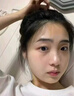 脸部凹陷填充液胶原蛋白太阳穴泪沟眼窝凹陷填充神器面部修复精华 买2赠1【三天变圆脸】 90ml 实拍图
