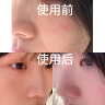 倩滋紫苏去黑头泥膜150g温和净黑头粉刺收敛毛孔涂抹式补水润肤面膜 实拍图