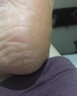 杨四郎皲裂膏50g脚裂膏脚后跟干裂老人手裂口脱皮脚跟龟裂男女士愈裂霜 橄榄油 2盒 干糙微裂细纹 实拍图