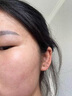 源药师 金花消痤颗粒 金花消痤疮颗粒痤疮粉刺去痘痘清热中药内调痤疮专用药 1盒*6袋【尝鲜装 建议按疗程服用】 实拍图