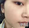 茜妃云南本草黄芪霜老牌子国货美白祛斑霜套装去黄淡斑去斑淡化黑色素 【60g单独祛斑霜】2瓶 实拍图