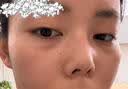 奢泉美冷敷贴微整术后修护红肿花敏晒后过敏瘙痒肌肤敏感肌肤院线产品女 奢泉美医用冷敷贴 一盒【5片】 实拍图