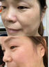 花恩诗美白祛斑霜淡斑雀斑黄褐斑晒斑妊娠斑淡化黑色素高维美白祛斑面霜 三盒【中度祛斑】 实拍图