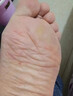 杨四郎脚医生脚气喷剂+凝胶脚痒脱皮水泡型脚臭汗泡脚液鞋袜脚臭粉套装 足喷50ml+膏30g+护足液500ml 实拍图