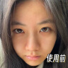 儒意（RUYI）水杨酸果酸次抛精华液补水收缩毛孔粗大祛痘修复淡化痘印痘坑男女 实拍图