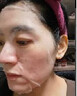 同仁堂祛痘补水面膜保湿净肤面贴膜草本成分控油青春粉刺痘男女草本去痘 【祛痘控油淡印】祛痘面膜1盒 5片 实拍图