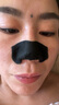 梦希蓝去黑头鼻贴猪鼻子草莓鼻撕拉式清洁毛孔吸黑头贴粉刺套装男女士 实发 20片 实拍图