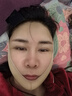 奥兰尚线雕面吸脂肪术后下颌绷带显瘦脸部面罩颈颌神器v脸塑形下颚头套 肤色 L （115-135斤左右） 实拍图