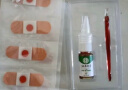 纯春堂云南本草鸡眼贴鸡眼膏去脚根肉刺无痛脱落跖疣瘊子脚底趾疣刺猴 周期套装（抑菌液*1+鸡眼贴12贴）含赠 实拍图