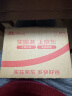 Dr.JYS30%冰醋酸溶液抑菌液灰指甲真菌感染涂抹脚气稀释泡脚高浓度醋酸 实拍图