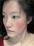 奢泉美冷敷贴微整术后修护红肿花敏晒后过敏瘙痒肌肤敏感肌肤院线产品女 奢泉美医用冷敷贴 一盒【5片】 实拍图