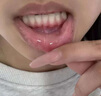 口腔溃疡特药效 上火清火的药 口疮生疮舌头起泡唇角起泡嘴巴溃烂红肿疼痛舌炎口腔溃疡喷剂 口洁喷雾剂 2盒装【上火口舌生疮】 实拍图