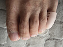 旅途漫步 脚趾受伤保护套脚趾防磨套柔软硅胶护指套脚趾头防鸡眼套透气 肤色带孔 小号4个【用于小脚趾】 实拍图