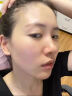 鲜一祛痘精华液377美白祛痘印淡化黑色素痘坑痘疤修护复去痘痘和痘印 祛痘印精华【单瓶装】 实拍图