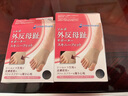 SORBOTHANE日本进口大拇指外翻矫正器可穿鞋男女脚趾矫正器脚骨突出分趾器 超薄型-左右各一只 S（34-36码） 实拍图