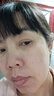MEANERSU激光祛斑点痣笔点疣瘊子扁平疣小肉粒球肉芽脸部激光祛斑仪器 9档+大礼包（联系客服指导使用） 实拍图