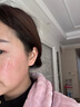 碧绽美山椒素特护乳50g华西专利保湿舒缓修护乳液【线下专款】 50g 实拍图