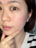 珂语祛痘精华液清痘凝胶小绿瓶去痘痘和痘印收敛毛孔修护青少年青春痘 【董璇推荐】祛痘凝胶1盒6支 实拍图