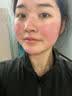 奢泉美冷敷贴微整术后修护红肿花敏晒后过敏瘙痒肌肤敏感肌肤院线产品女 奢泉美玻尿酸水光补水保湿面膜 一盒【5片】 实拍图