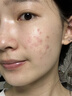 DR.XME 向美博士硫磺洗面奶男女士收缩毛孔去黑白头控油清洁螨虫祛痘去角质洁面乳 1瓶体验装【日常清洁控油除螨】 实拍图